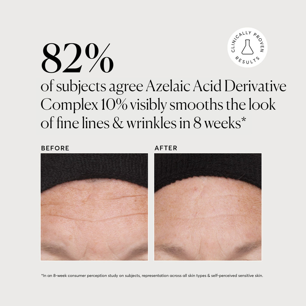azelaic-acid-derivative-complex-10-jumbo-v8 NATR-10023-Alt-Images-Azelaic-Acid-Derivative-Complex-10_-043.jpg