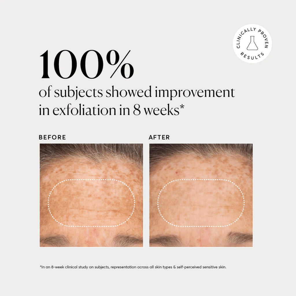 bha-liquid-exfoliant-2-w8 NATR-10027-Alt-Images-BHA-Liquid-Exfoliant-2_-03.webp