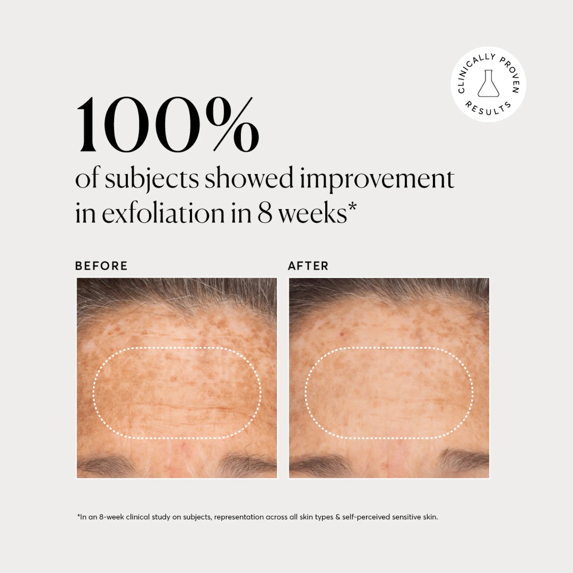 bha-liquid-exfoliant-2-w8 NATR-10027-Alt-Images-BHA-Liquid-Exfoliant-2_-03.webp