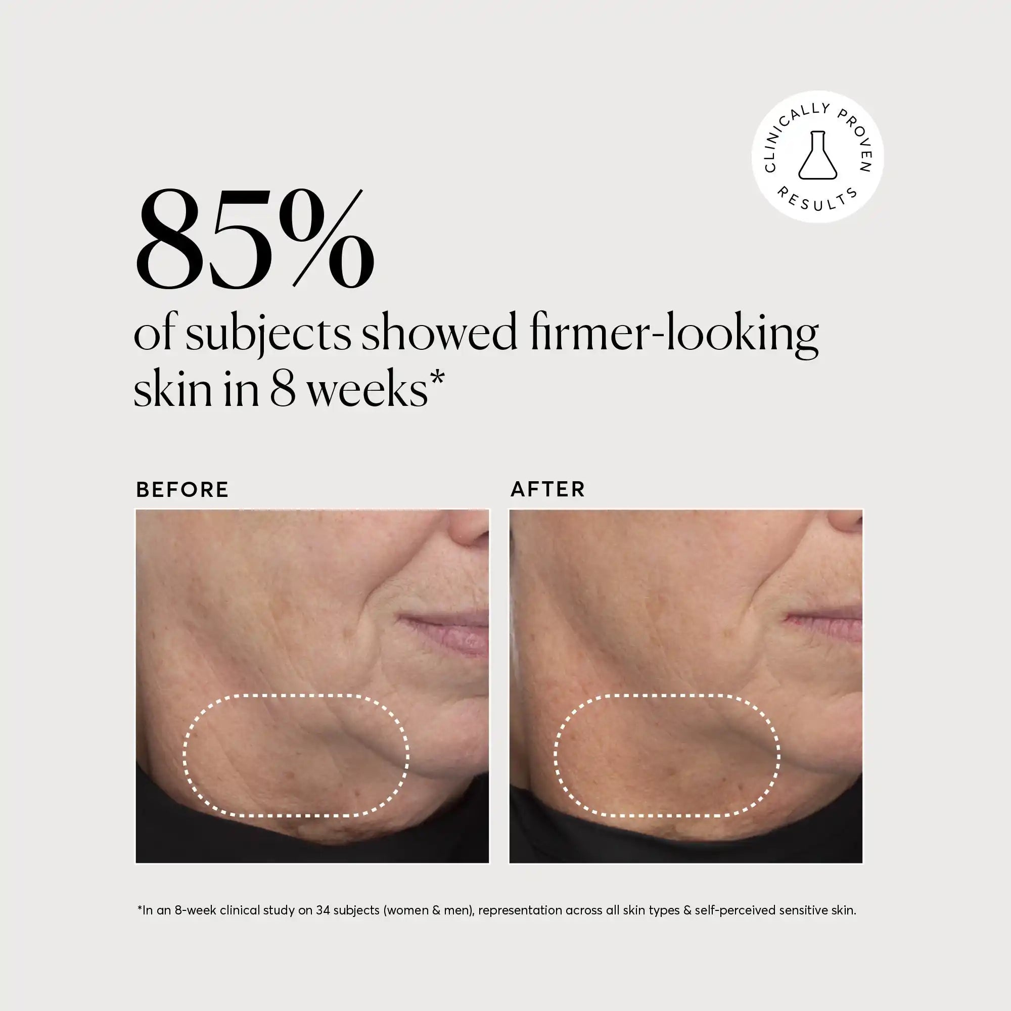retinol-complex-serum-g1 NATR-10034-Alt-Images-Retinol-Complex-Serum-04.webp